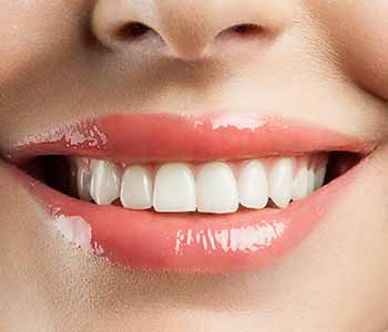  Dr. Hanif Asaria and the team at Calgary Dental Centers offer customized teeth whitening using at-home trays.