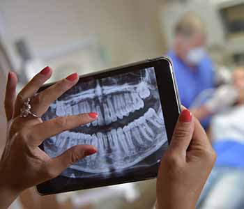 When are X-rays completed? - The Importance of Dental X-rays in Calgary AB